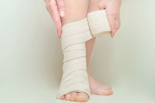Compression bandage after surgery for varicose veins
