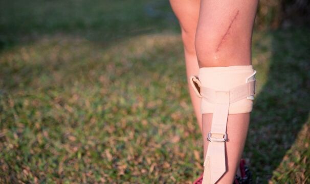 Restoring the legs after surgery for varicose veins