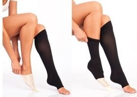 Put on compression stockings if you have varicose veins