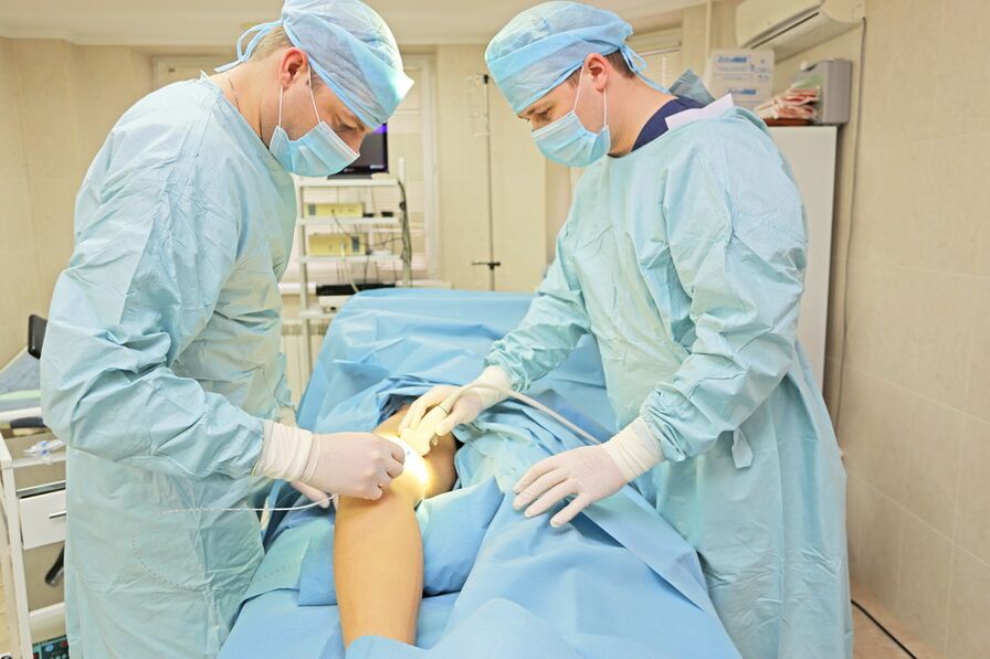 Surgery for varicose veins of the pelvis