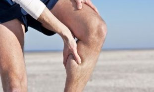 Varicose veins on the legs in men